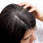Peneliti Temukan Antioksidan Alami yang Bisa Mencegah Rambut Beruban